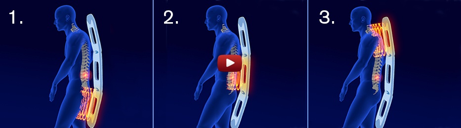 Applicatore della magnetoterapia 3D per applicazione alzato